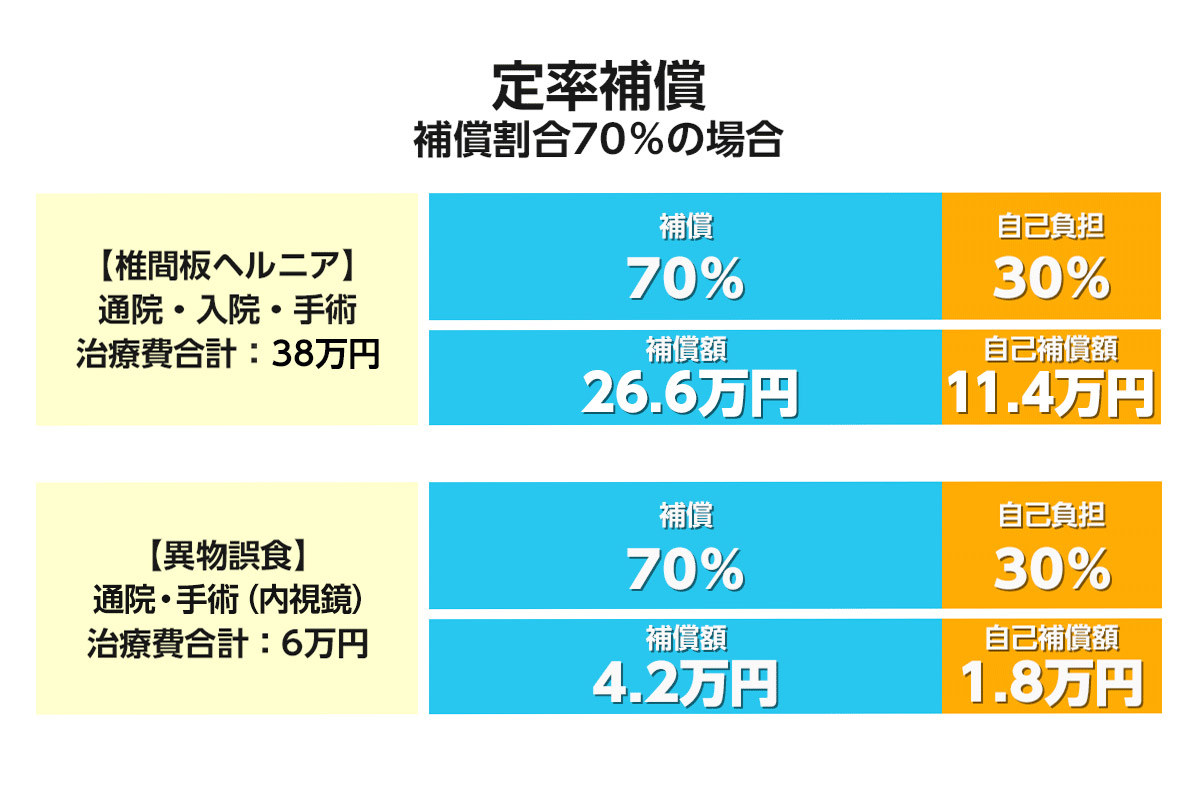 「定率補償」