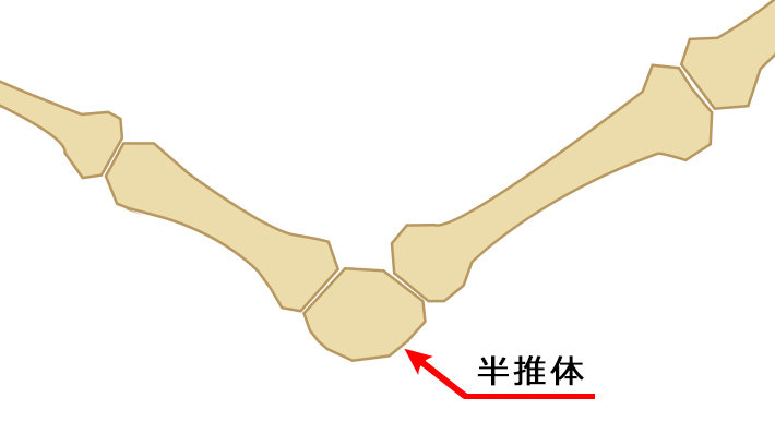 尾椎の一部が変形して半椎体化すると、かぎ状の折れ曲がった状態